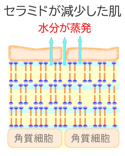 セラミドが減少した肌