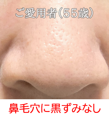 Silkクレンジングジェル オイルフリー 界面活性剤不使用 優れた毛穴の角栓取り Silkシルキーズ